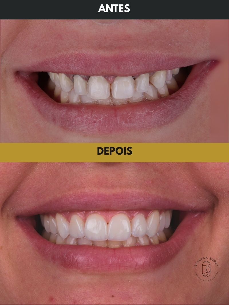 Antes e depois - Case 1
