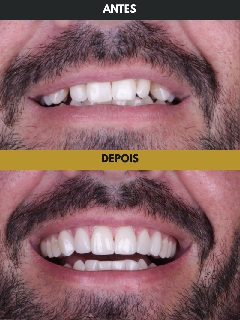Antes e depois - Case 10