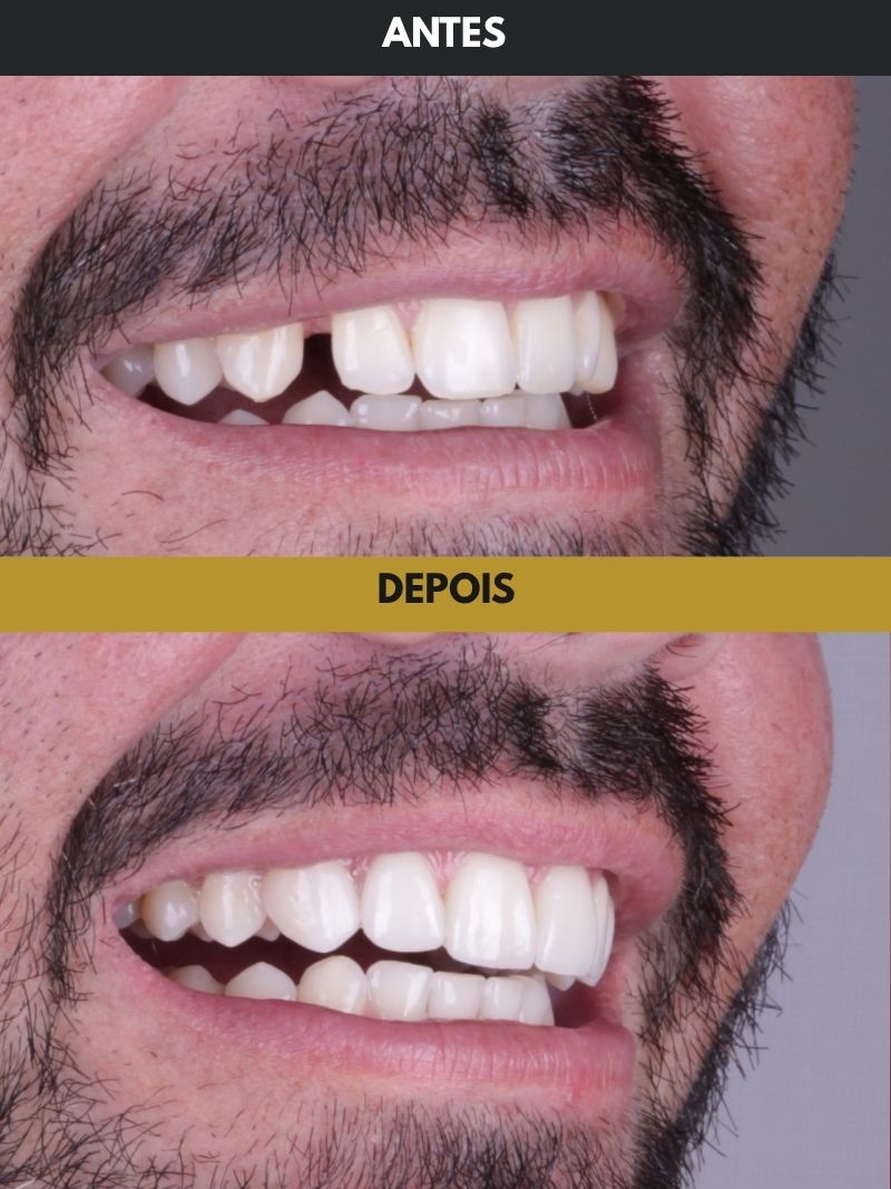Antes e depois - Case 7