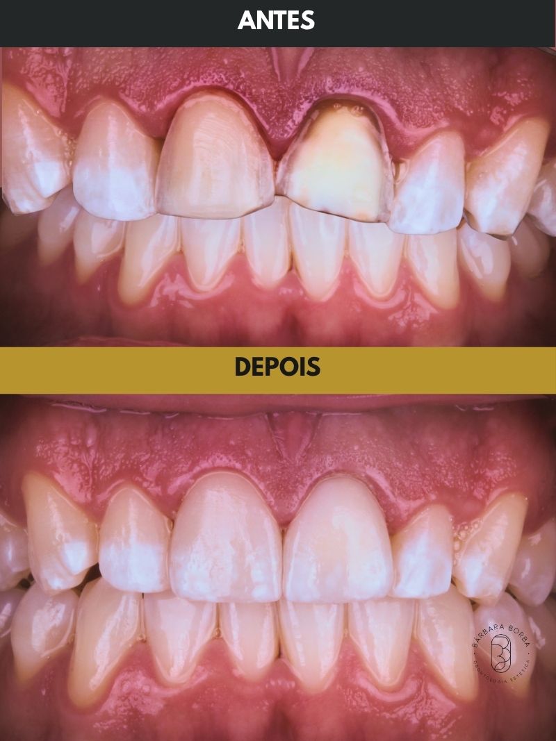 Antes e depois - Case 8