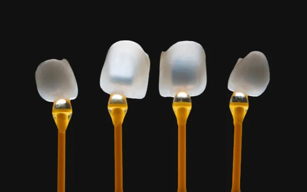 Facetas dentárias - Dra. Bárbara Borba